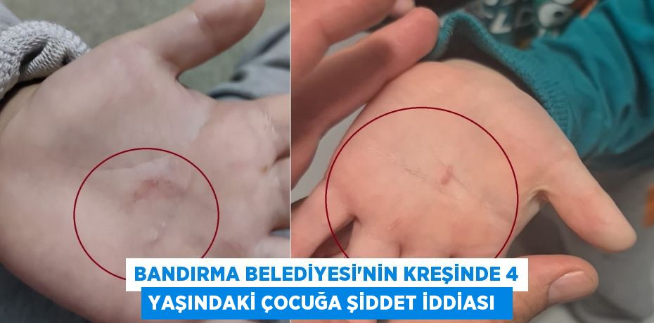 Bandırma Belediyesi'nin kreşinde 4 yaşındaki çocuğa şiddet iddiası 