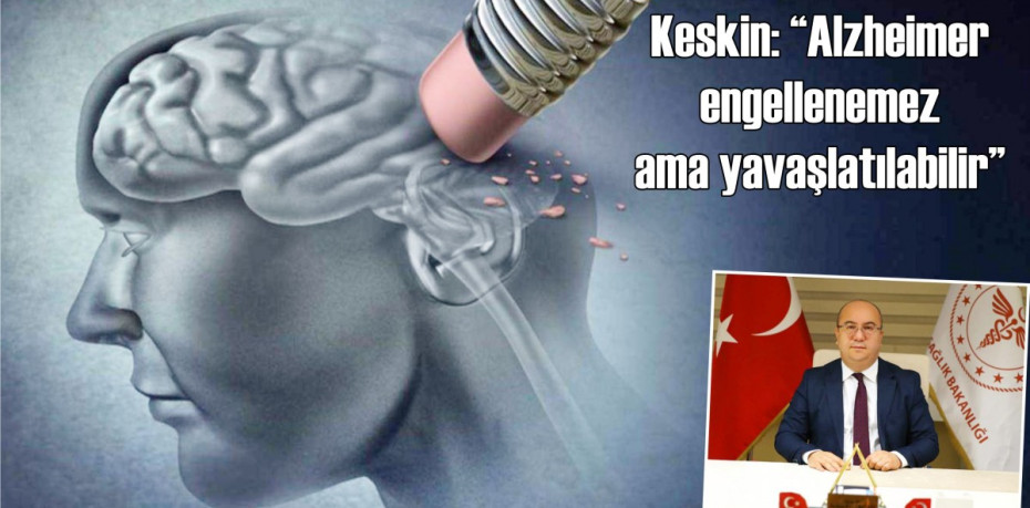 Keskin: “Alzheimer engellenemez ama yavaşlatılabilir”