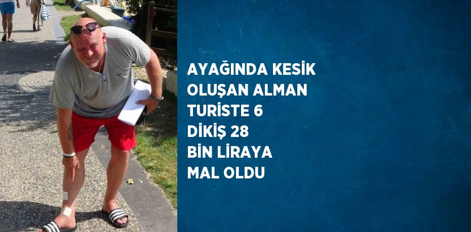 AYAĞINDA KESİK OLUŞAN ALMAN TURİSTE 6 DİKİŞ 28 BİN LİRAYA MAL OLDU