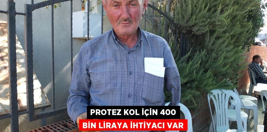 Protez kol için 400 bin liraya ihtiyacı var