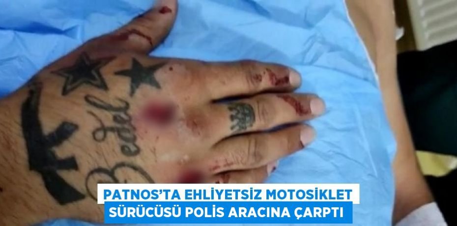 PATNOS’TA EHLİYETSİZ MOTOSİKLET SÜRÜCÜSÜ POLİS ARACINA ÇARPTI