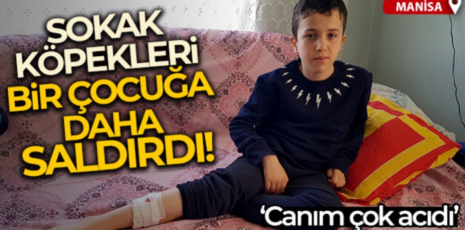 Sokak köpekleri bir çocuğa daha saldırdı