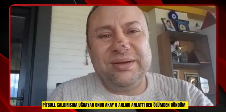 Pitbull saldırısına uğrayan Onur Akay o anları anlattı: "Ben ölümden döndüm"  