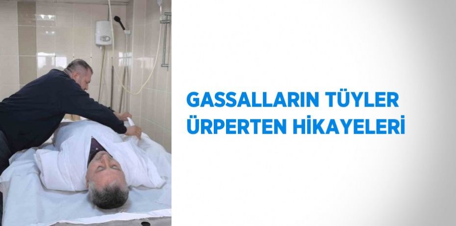 GASSALLARIN TÜYLER ÜRPERTEN HİKAYELERİ